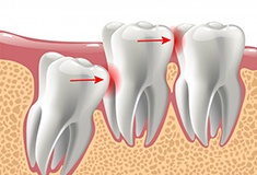 Lady has oral pain